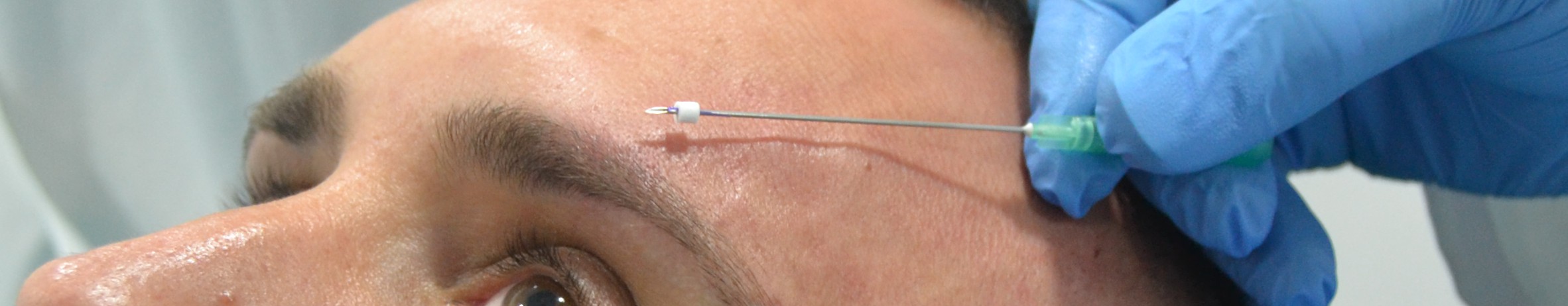 hilos tensores de PDO